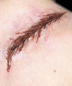 Woochie Latex Prosthetic Back Lash Prosthetics