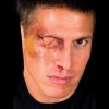 Prosthetics Woochie Latex Prosthetic Swollen Eye